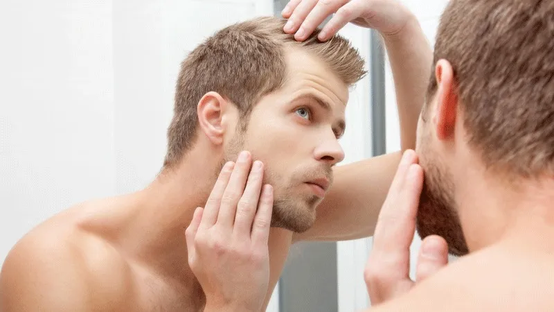 10 migliori trattamenti per il diradamento dei capelli negli uomini