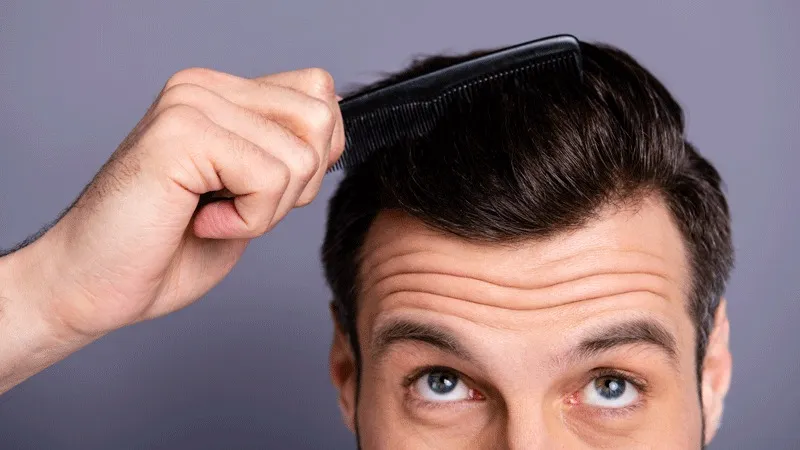 Trapianto di capelli DHI e FUE: Quale è meglio?