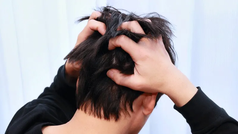 Quali sono le cause del prurito dopo il trapianto di capelli?